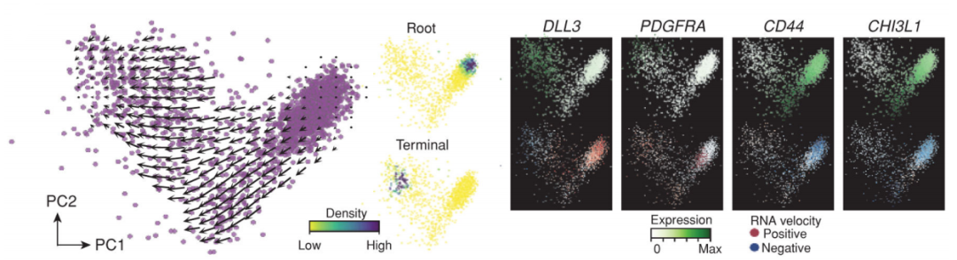 膠質(zhì)母細(xì)胞瘤干細(xì)胞樣細(xì)胞分化軌跡