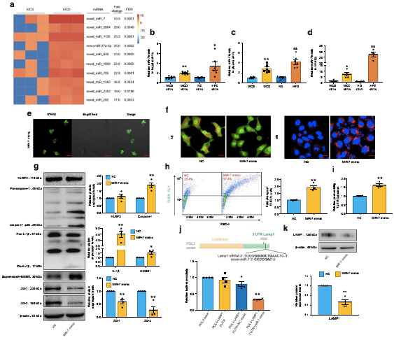 NAFLD肝源性外泌體通過激活組織蛋白酶B/NLRP3免疫激酶體軸誘導(dǎo)微血管內(nèi)皮細(xì)胞高通透性